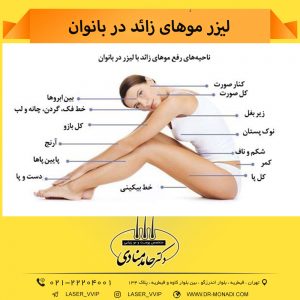 لیزر موهای زائد در بانوان