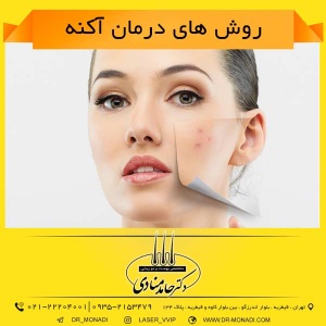 روش های درمان آکنه دکتر حامد منادی