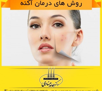 روش های درمان آکنه دکتر حامد منادی