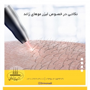 نکاتی در خصوص لیزر موهای زائد