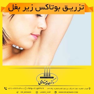 تزریق بوتاکس زیر بغل دکتر حامد منادی