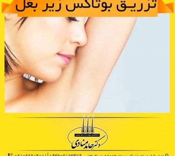 تزریق بوتاکس زیر بغل دکتر حامد منادی