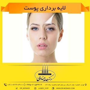 لایه برداری پوست دکتر حامد منادی