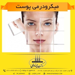 میکرودرمی پوست دکتر حامد منادی
