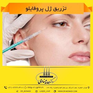 تزریق ژل پروفایلو دکتر حامد منادی