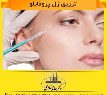 تزریق ژل پروفایلو دکتر حامد منادی
