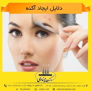 دلایل ایجاد آکنه دکتر حامد منادی