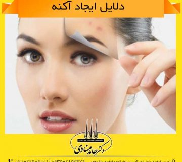 دلایل ایجاد آکنه دکتر حامد منادی