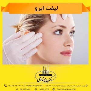 لیفت ابرو دکتر حامد منادی