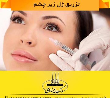 تزریق ژل زیر چشم دکتر حامد منادی