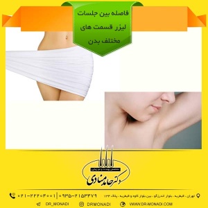 فاصله بین جلسات لیزر موهای زائد دکتر حامد منادی