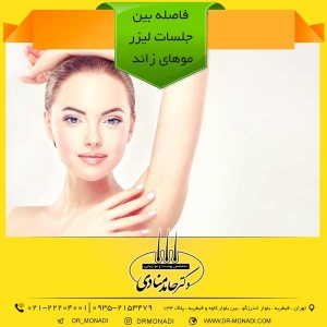 فاصله بین جلسات لیزر موهای زائد دکتر حامد منادی