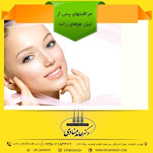 نکاتی درباره لیزر موهای زائد دکتر حامد منادی