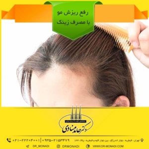 رفع ریزش مو با مصرف زینک دکتر حامد منادی