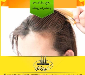 رفع ریزش مو با مصرف زینک دکتر حامد منادی