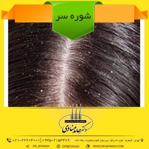 شوره سر دکتر حامد منادی