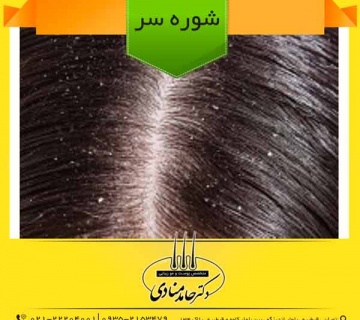 شوره سر دکتر حامد منادی