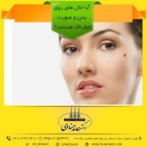 آیا خال‌ های روی بدن و صورت خطرناک هستند؟ دکتر حامد منادی