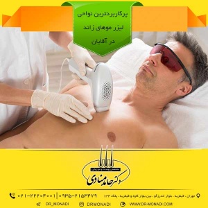 پرکاربردترین نواحی لیزر موهای زائد در آقایان دکتر حامد منادی