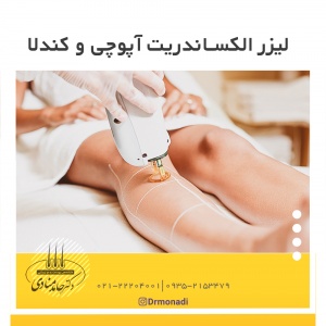 لیزر الکساندریت آپوچی و کندلا