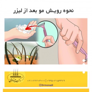نحوه رویش مو بعد از لیزر