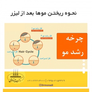 نحوه ریختن موها بعد از لیزر