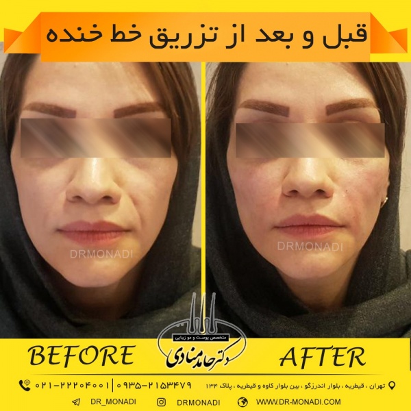 Drmonadi1400-5-19 (11)