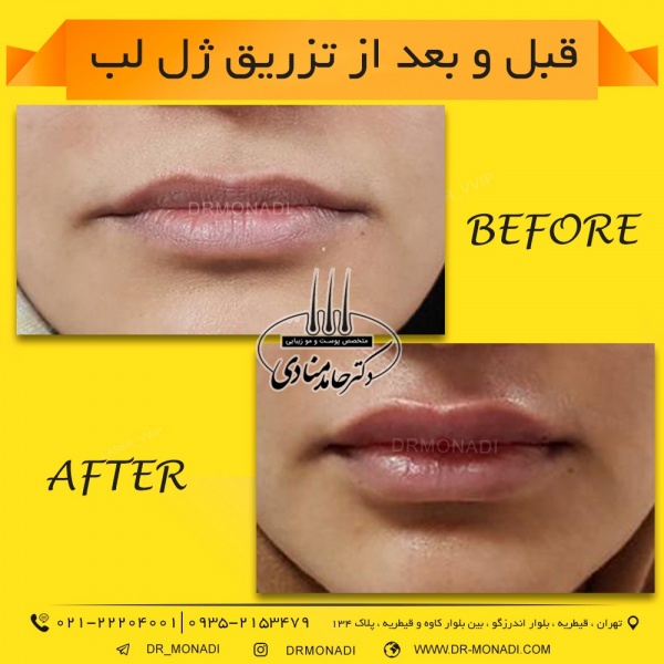 Drmonadi1400-5-19 (12)