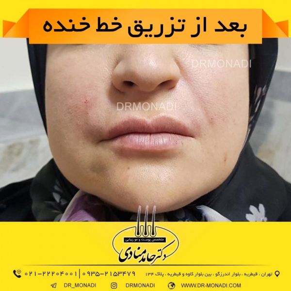 Drmonadi1400-5-19 (13)