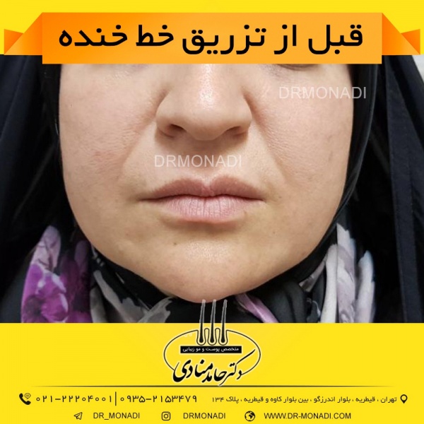 Drmonadi1400-5-19 (14)