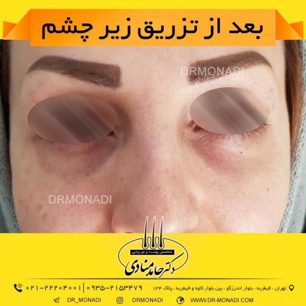 Drmonadi1400-5-19 (15)