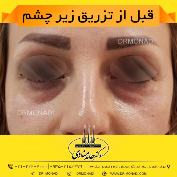 Drmonadi1400-5-19 (16)