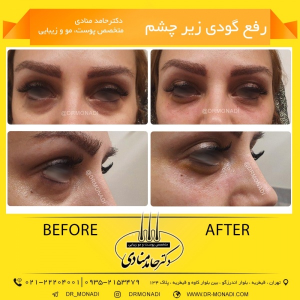 Drmonadi1400-5-19 (23)