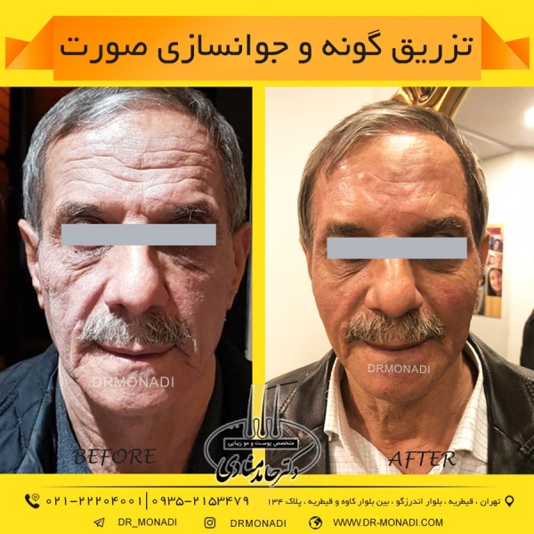 Drmonadi1400-5-19 (25)