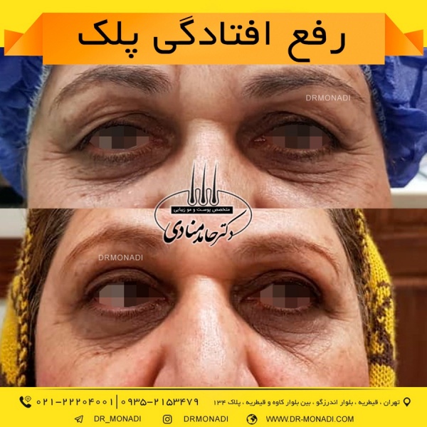 Drmonadi1400-5-19 (26)