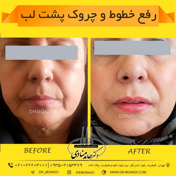 Drmonadi1400-5-19 (28)