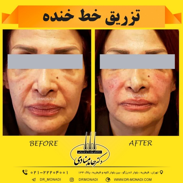 Drmonadi1400-5-19 (29)