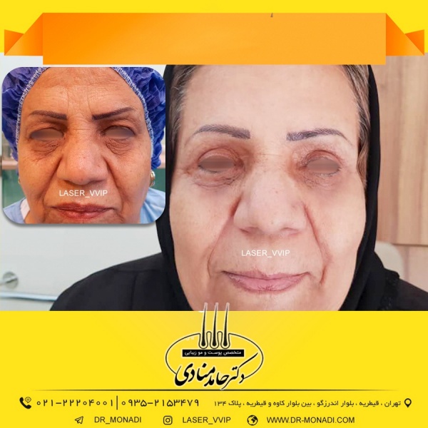 دکتر حامد منادی